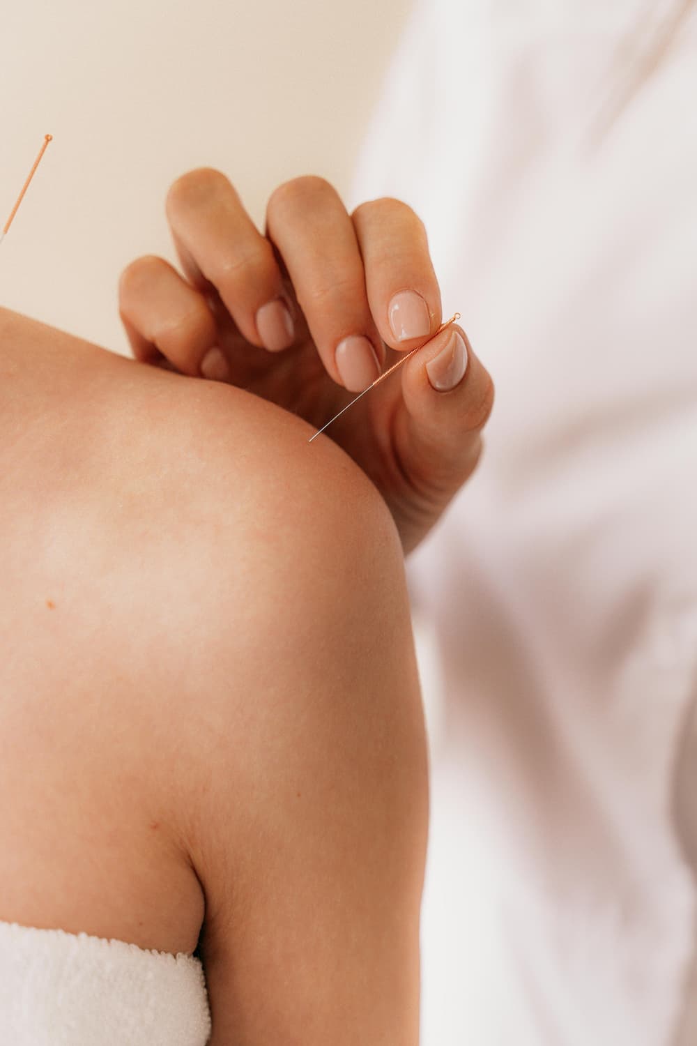 Women's acupuncture demonstration in shoulder